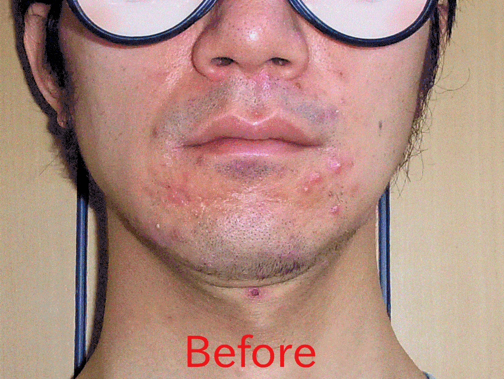 1417086151CGU1d9pQP72vtUq1417086147